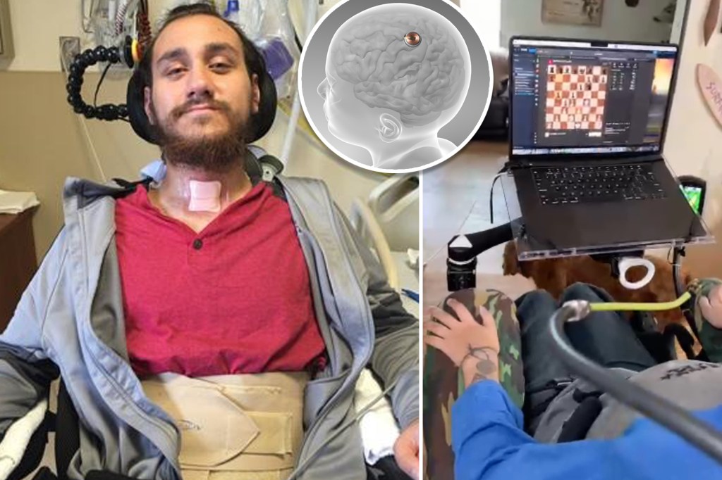 Neuralink’s First Human Trial: A Comprehensive&nbsp;Overview